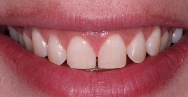 Before treatment 3