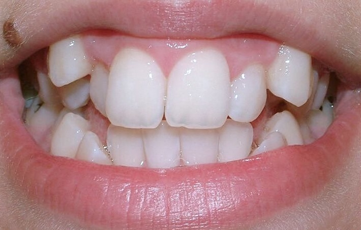 Before treatment 4