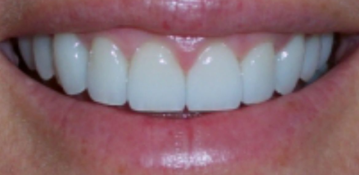 Final Result